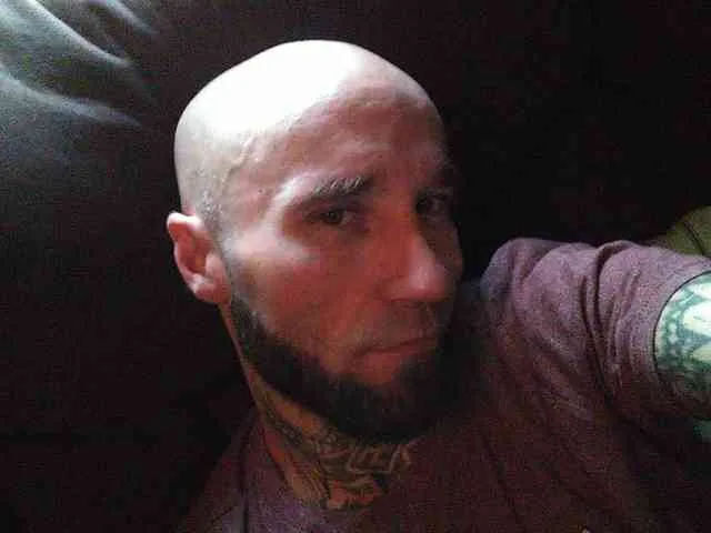 Skinhead148800