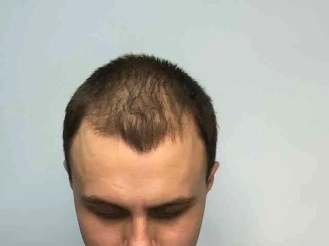 MarkusxxxL