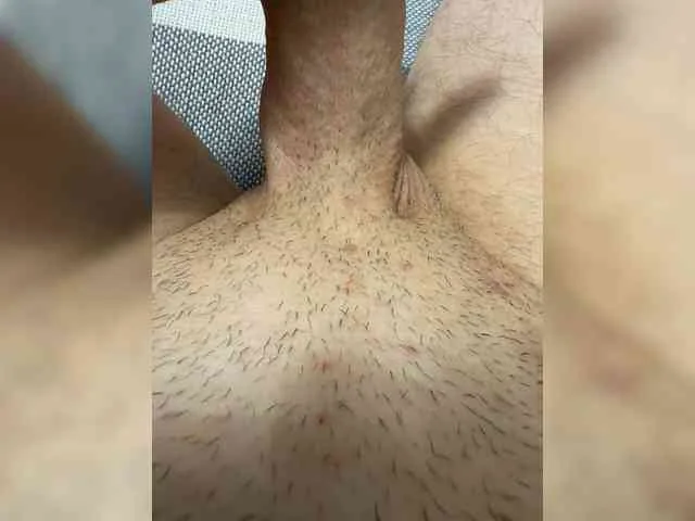 Mi9