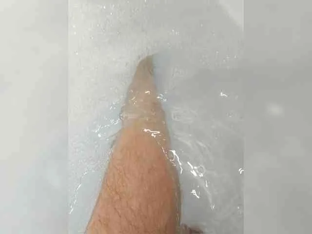 Skabasis21