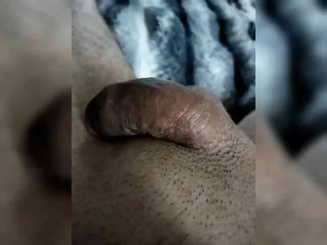 Glo-2