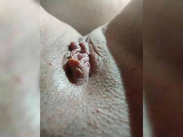 Anal-Anal